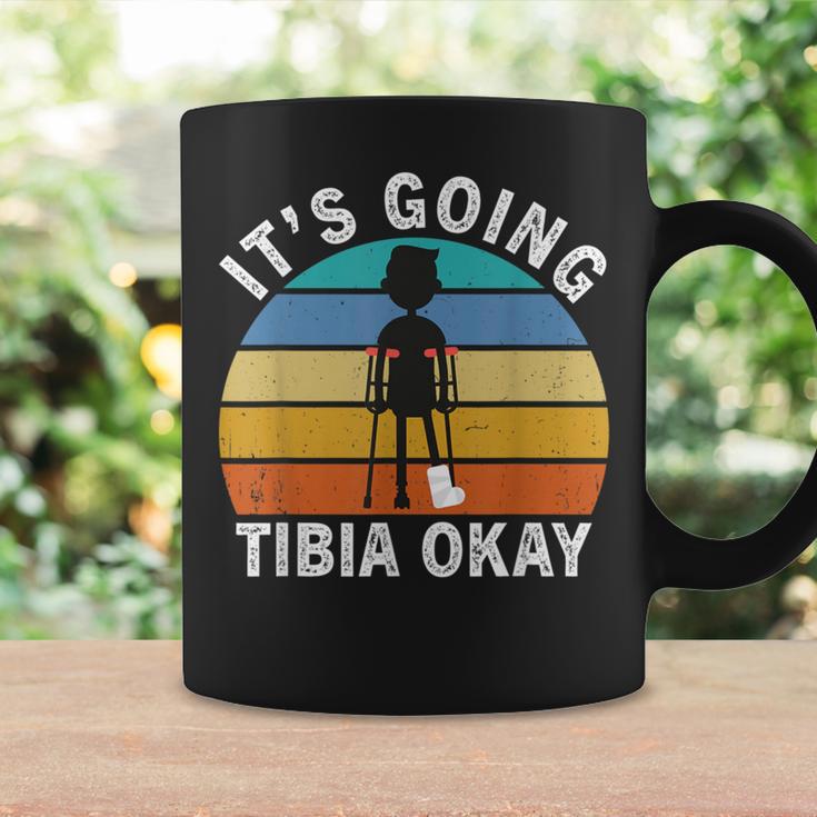 Retro Broken Leg It's Going Tibia Okay Human Bone Anatomy Graphic Print ...